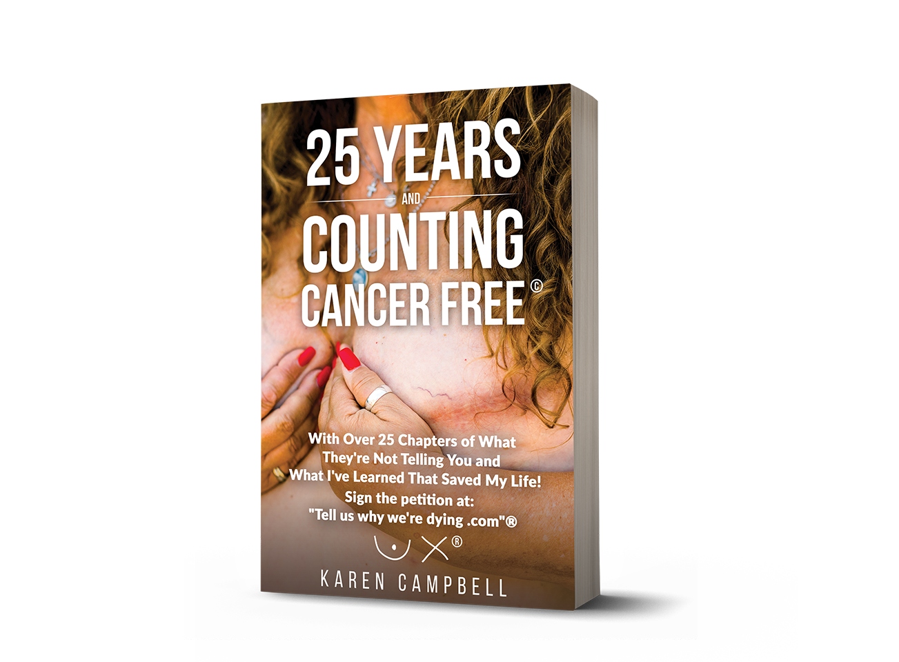 25 Years and Counting Cancer Free©
